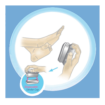 Callus Sander